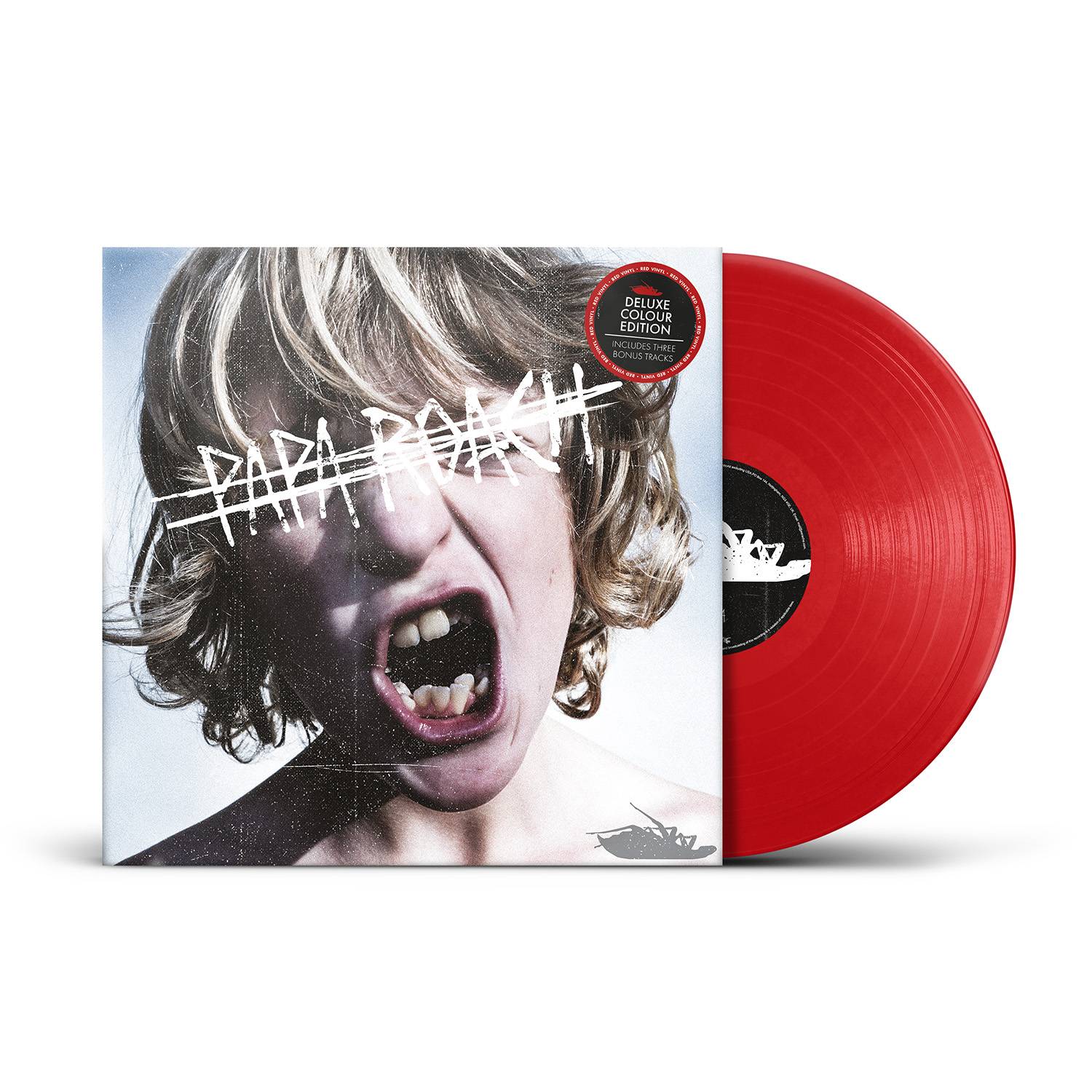 Crooked Teeth - Image 2