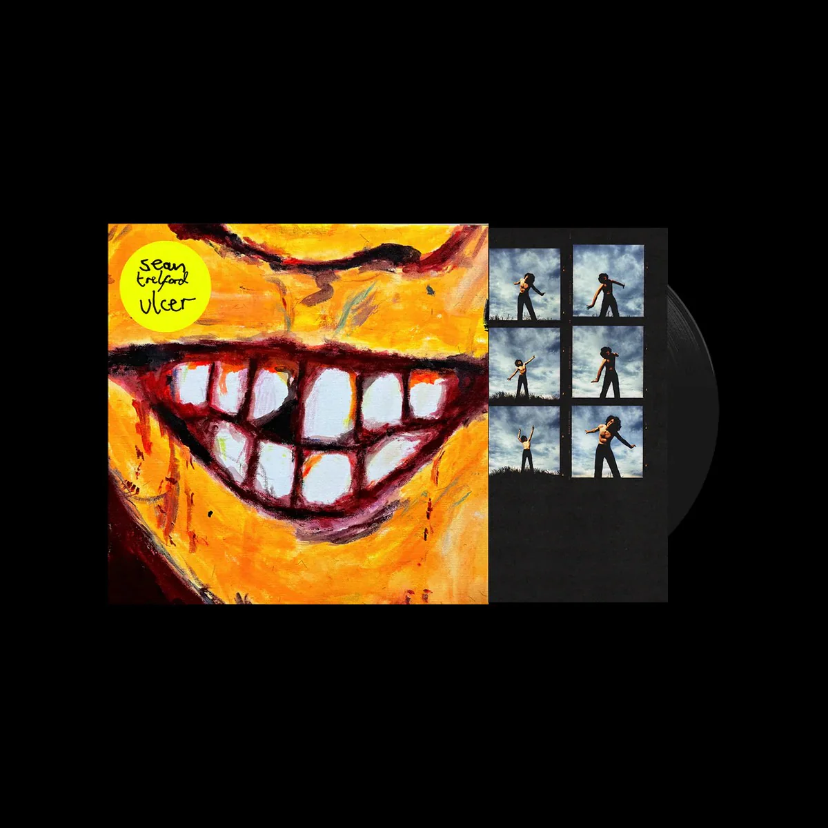 Ulcer - Image 2